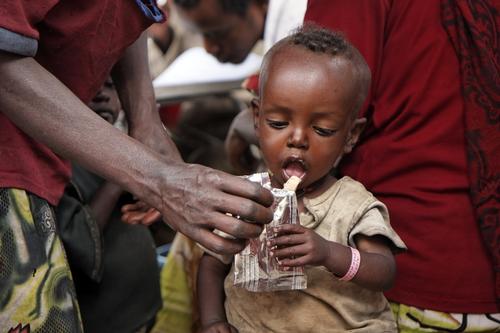 Nutrition centers for malnourished people (severe and modaretely cases) Nutrition centers for malnourished people (severe and modaretely cases)